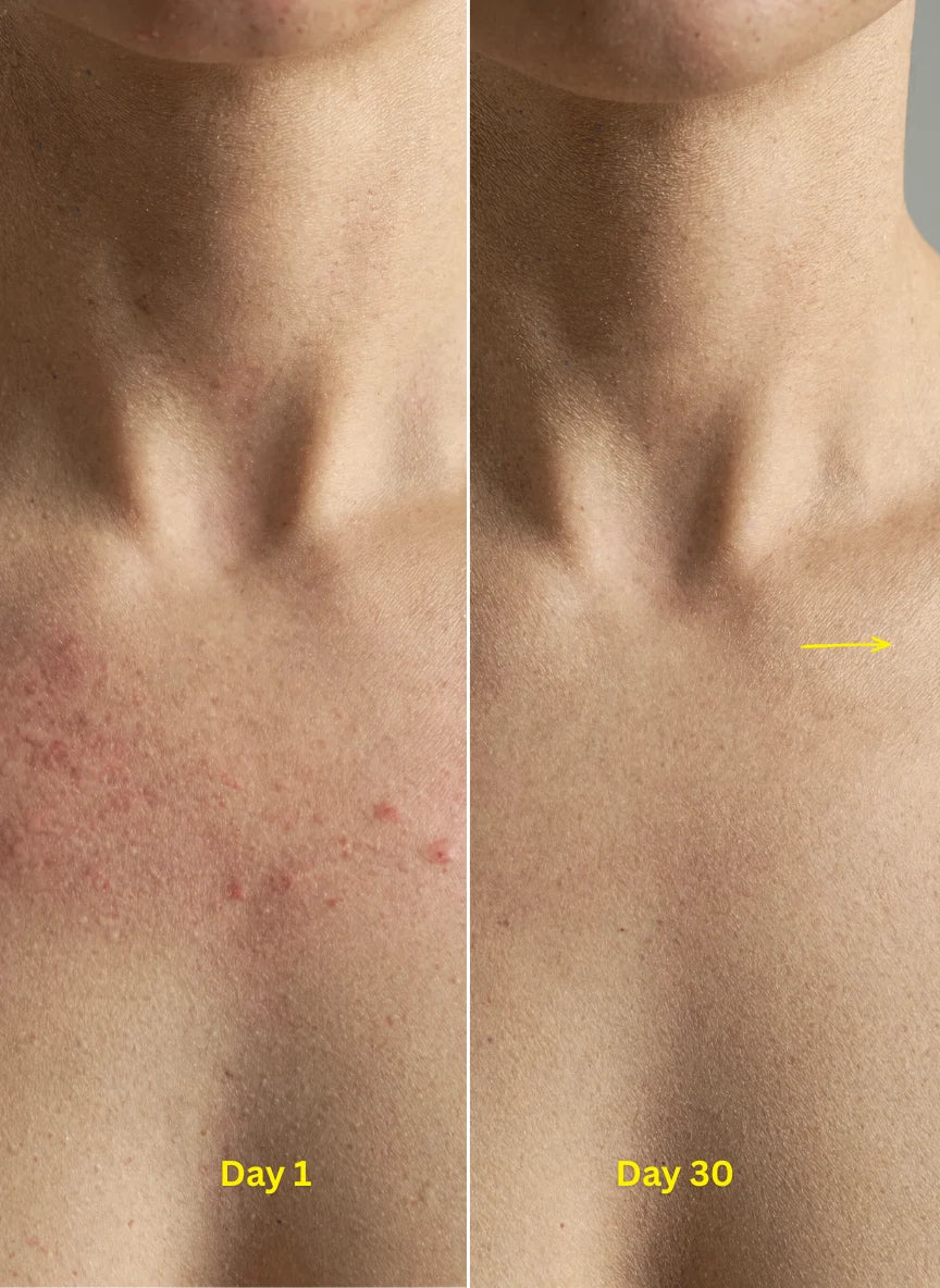 Helps reduce dryness, irritation and post-shower itching